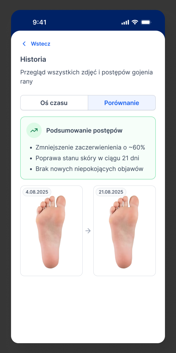 Diabetic Foot Care - zdjęcie 8